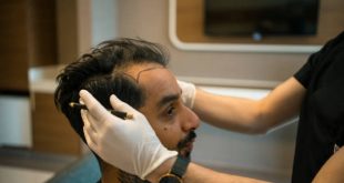 Hair Transplant in Riyadh