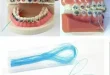 Dental Braces Treatment