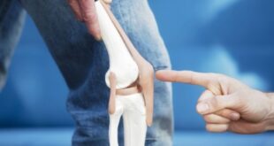 Knee Replacement Surgery Cost in Pakistan