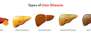 Types of Liver Disease