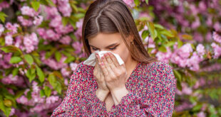 seasonal allergies in fresno and Merced